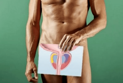 Prostatite infettiva acuta
