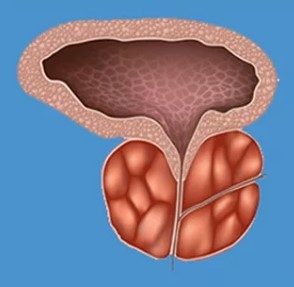I segni caratteristici della prostatite