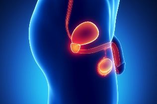 L'infiammazione della prostata